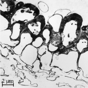 Secondarily-thickened walls of rind cells